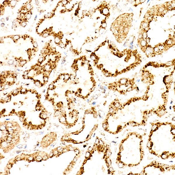 LAMP2 Rabbit polyclonal antibody