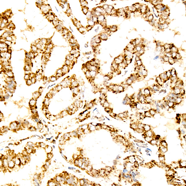 LAMP2 Rabbit polyclonal antibody