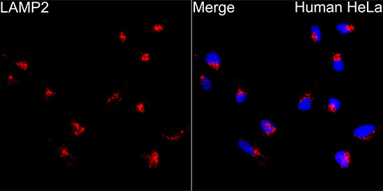 LAMP2 Rabbit polyclonal antibody