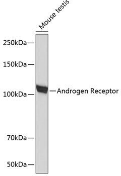Androgen Receptor Rabbit monoclonal antibody