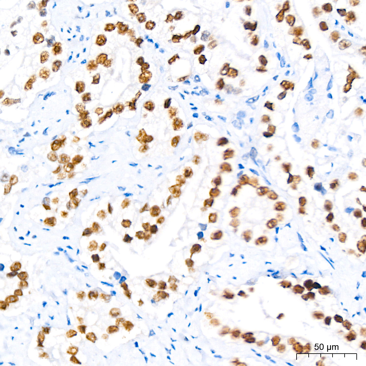 Androgen Receptor Rabbit monoclonal antibody
