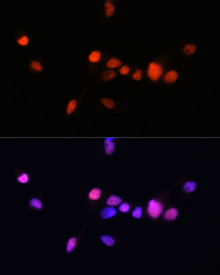 Androgen Receptor Rabbit monoclonal antibody