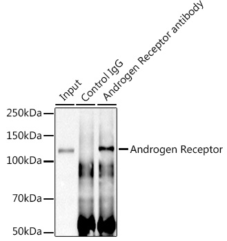 Androgen Receptor Rabbit monoclonal antibody