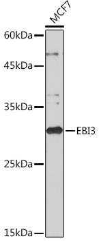 EBI3 Rabbit monoclonal antibody