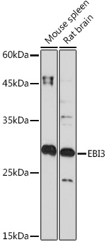 EBI3 Rabbit monoclonal antibody