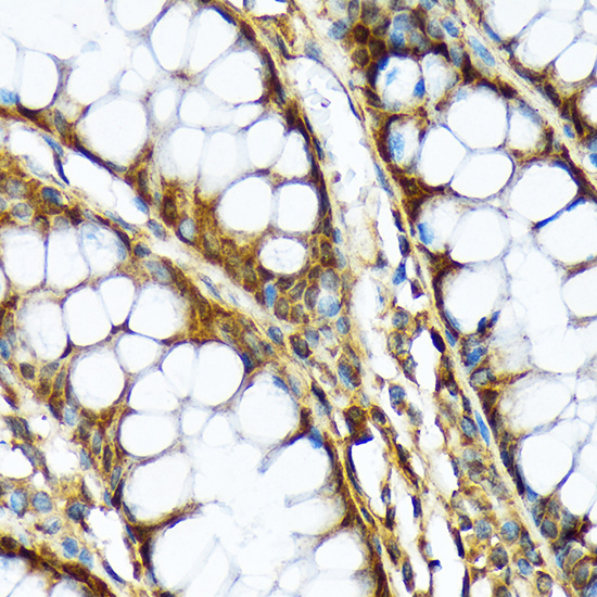 ABCF1 Rabbit monoclonal antibody