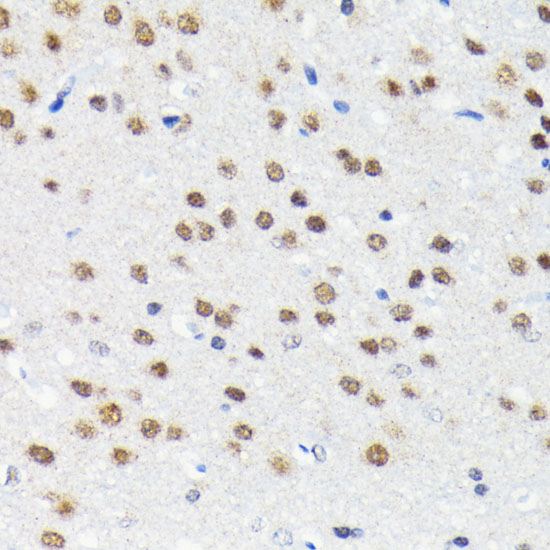 Cullin 3 Rabbit monoclonal antibody