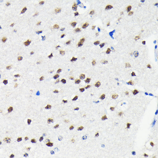Cullin 3 Rabbit monoclonal antibody