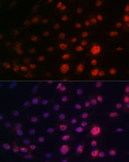 CRM1/XPO1 Rabbit monoclonal antibody