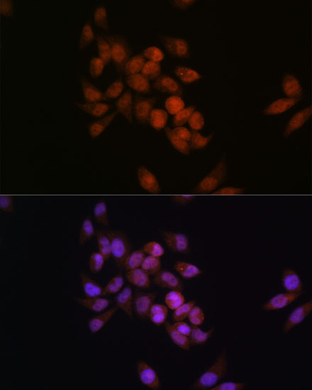 CRM1/XPO1 Rabbit monoclonal antibody