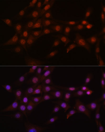 CRM1/XPO1 Rabbit monoclonal antibody