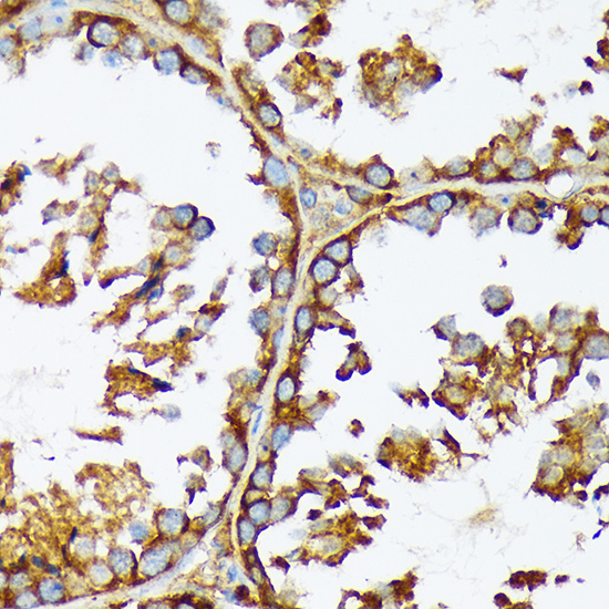 ACC1 Rabbit monoclonal antibody