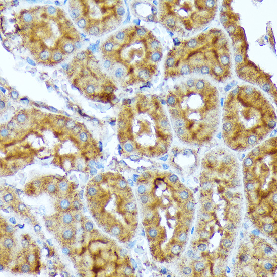 ACC1 Rabbit monoclonal antibody