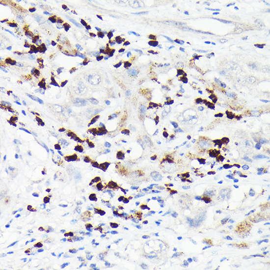 MMP8 Rabbit polyclonal antibody