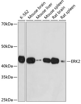 ERK2 Rabbit monoclonal antibody