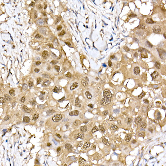 ERK2 Rabbit monoclonal antibody