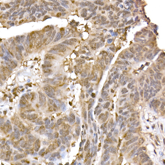 ERK2 Rabbit monoclonal antibody