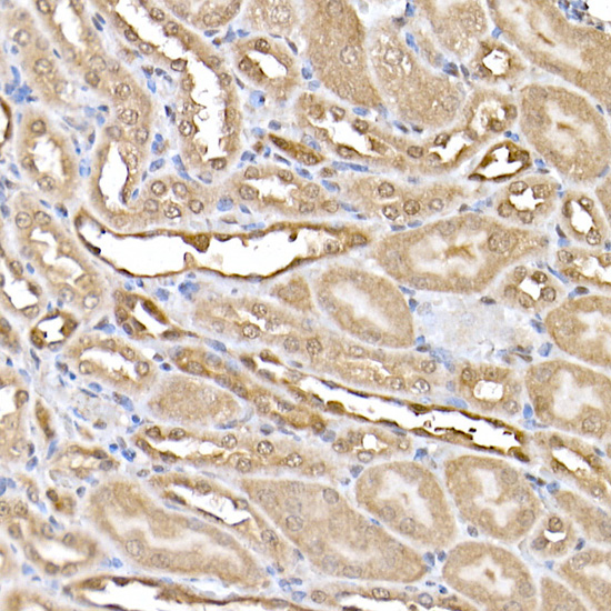 ERK2 Rabbit monoclonal antibody