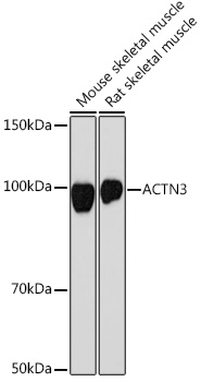 ACTN3 Rabbit monoclonal antibody