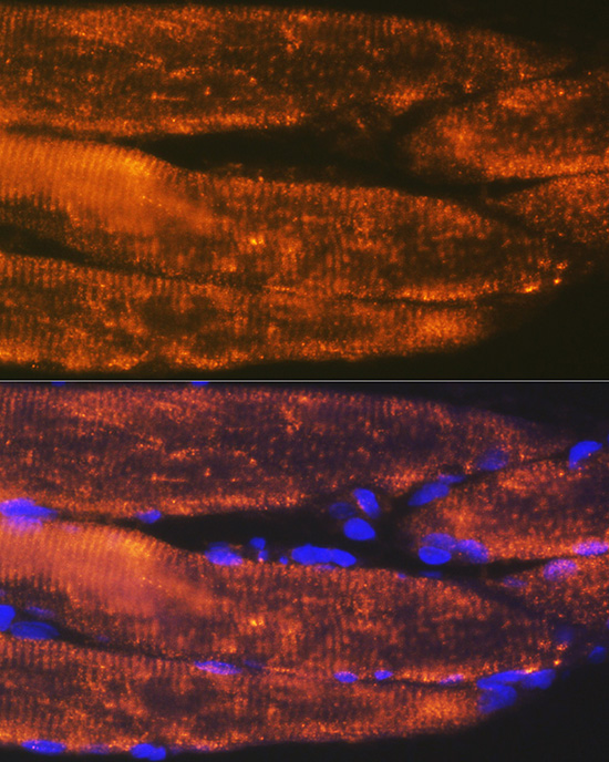 ACTN3 Rabbit monoclonal antibody