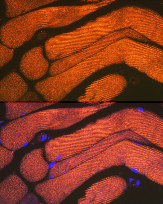 ACTN3 Rabbit monoclonal antibody