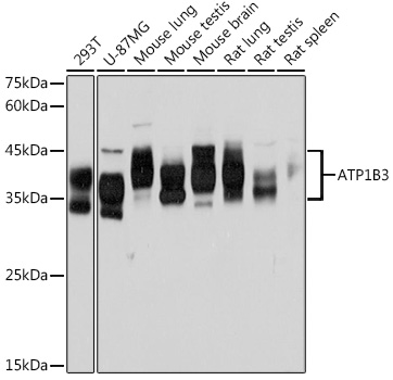 ATP1B3 Rabbit monoclonal antibody