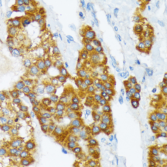 ATP1B3 Rabbit monoclonal antibody