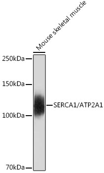 SERCA1/ATP2A1 Rabbit monoclonal antibody