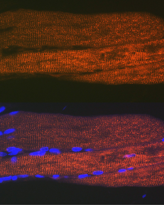 SERCA1/ATP2A1 Rabbit monoclonal antibody
