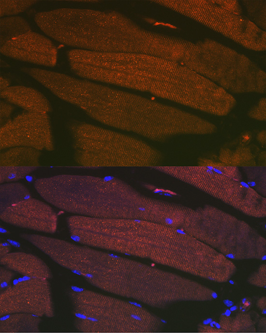 SERCA1/ATP2A1 Rabbit monoclonal antibody
