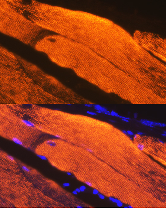 Calsequestrin 1 Rabbit monoclonal antibody