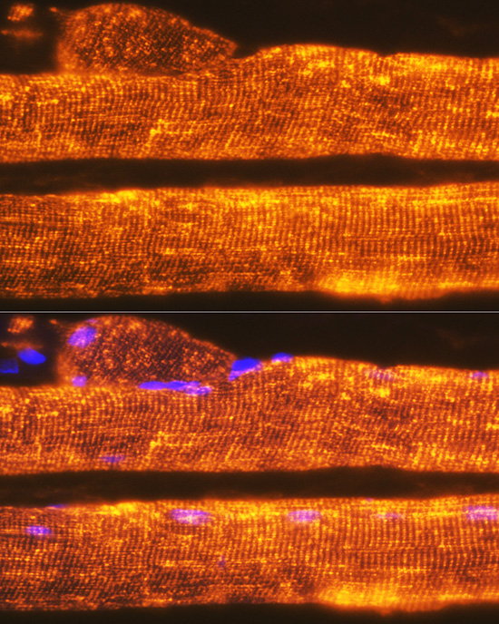 Calsequestrin 1 Rabbit monoclonal antibody