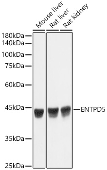 ENTPD5 Rabbit monoclonal antibody