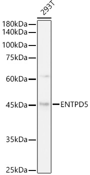 ENTPD5 Rabbit monoclonal antibody