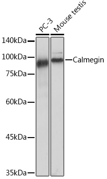 Calmegin Rabbit monoclonal antibody