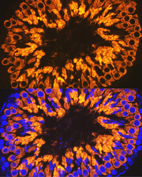 Calmegin Rabbit monoclonal antibody