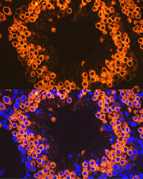 Calmegin Rabbit monoclonal antibody