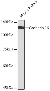 Cadherin 16 Rabbit monoclonal antibody