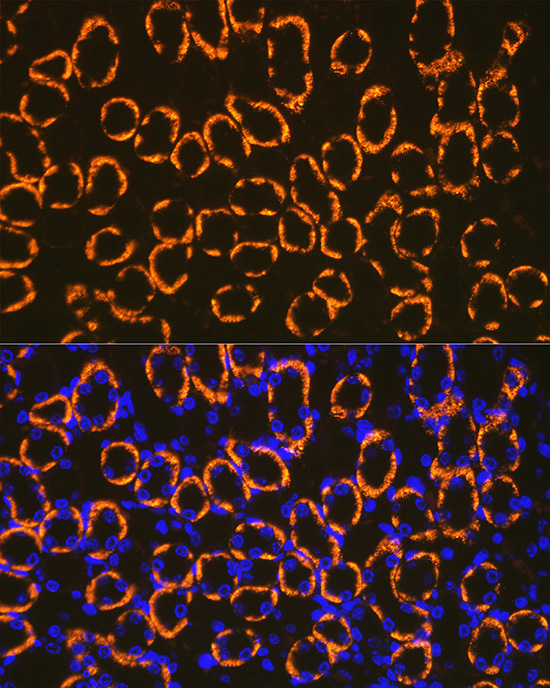 Cadherin 16 Rabbit monoclonal antibody