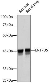 ENTPD5 Rabbit monoclonal antibody