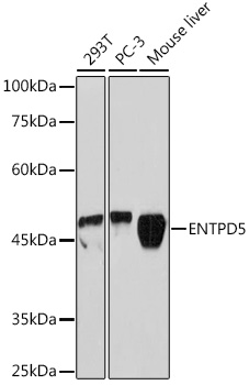 ENTPD5 Rabbit monoclonal antibody