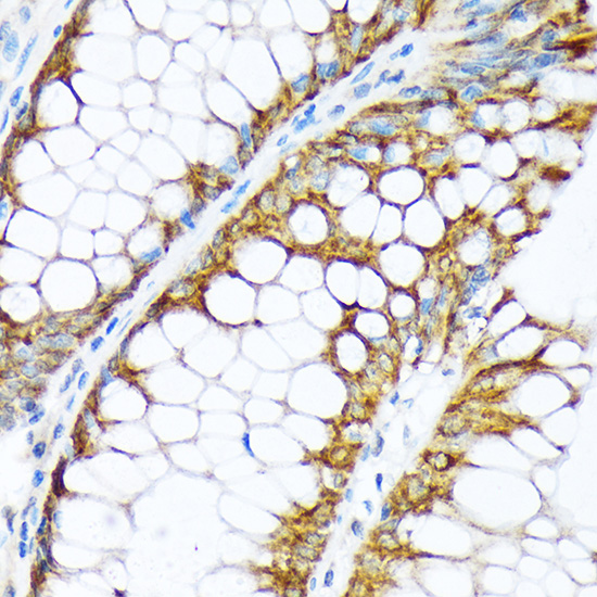 ENTPD5 Rabbit monoclonal antibody