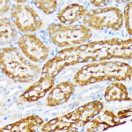 ENTPD5 Rabbit monoclonal antibody