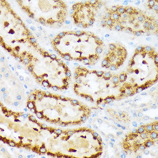 ENTPD5 Rabbit monoclonal antibody