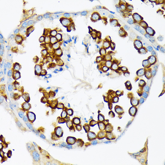 Calmegin Rabbit monoclonal antibody