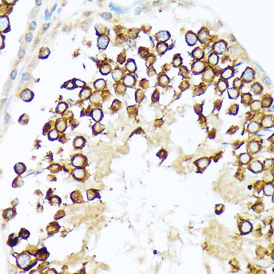 Calmegin Rabbit monoclonal antibody