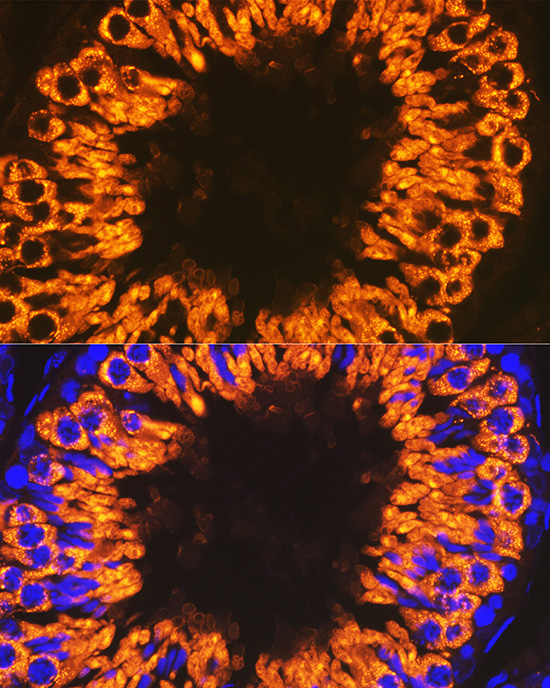 Calmegin Rabbit monoclonal antibody