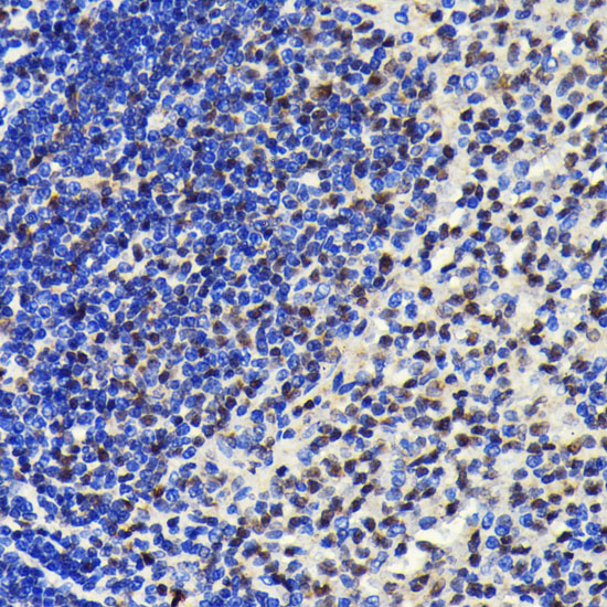 SP1 Rabbit monoclonal antibody