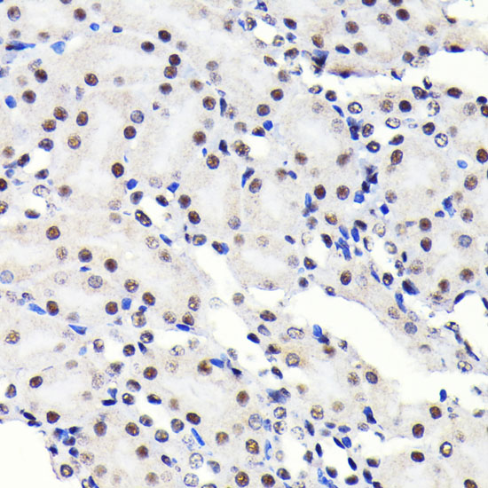 SP1 Rabbit monoclonal antibody