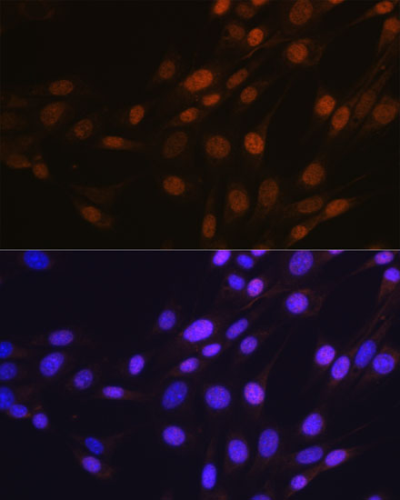 SP1 Rabbit monoclonal antibody